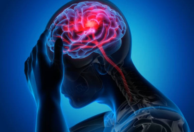 Local Vibration Therapy for Stroke Patients - Pulse Device