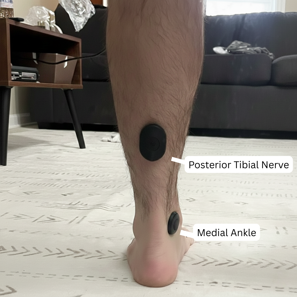 Pulse Device being used over the posterior tibial nerve and medial ankle at home.