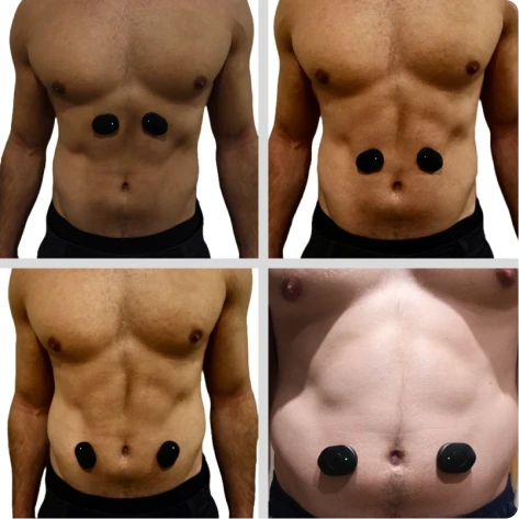 Abdominals