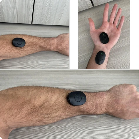 Hand, Wrist, Forearm